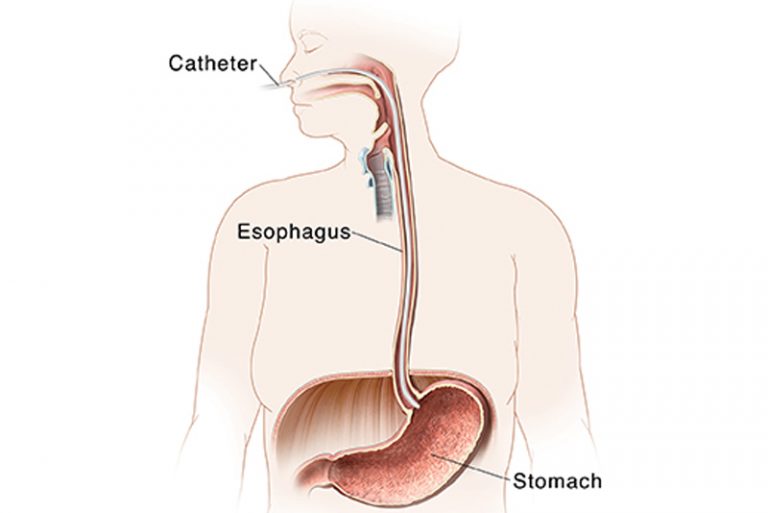 Esophageal Manometry