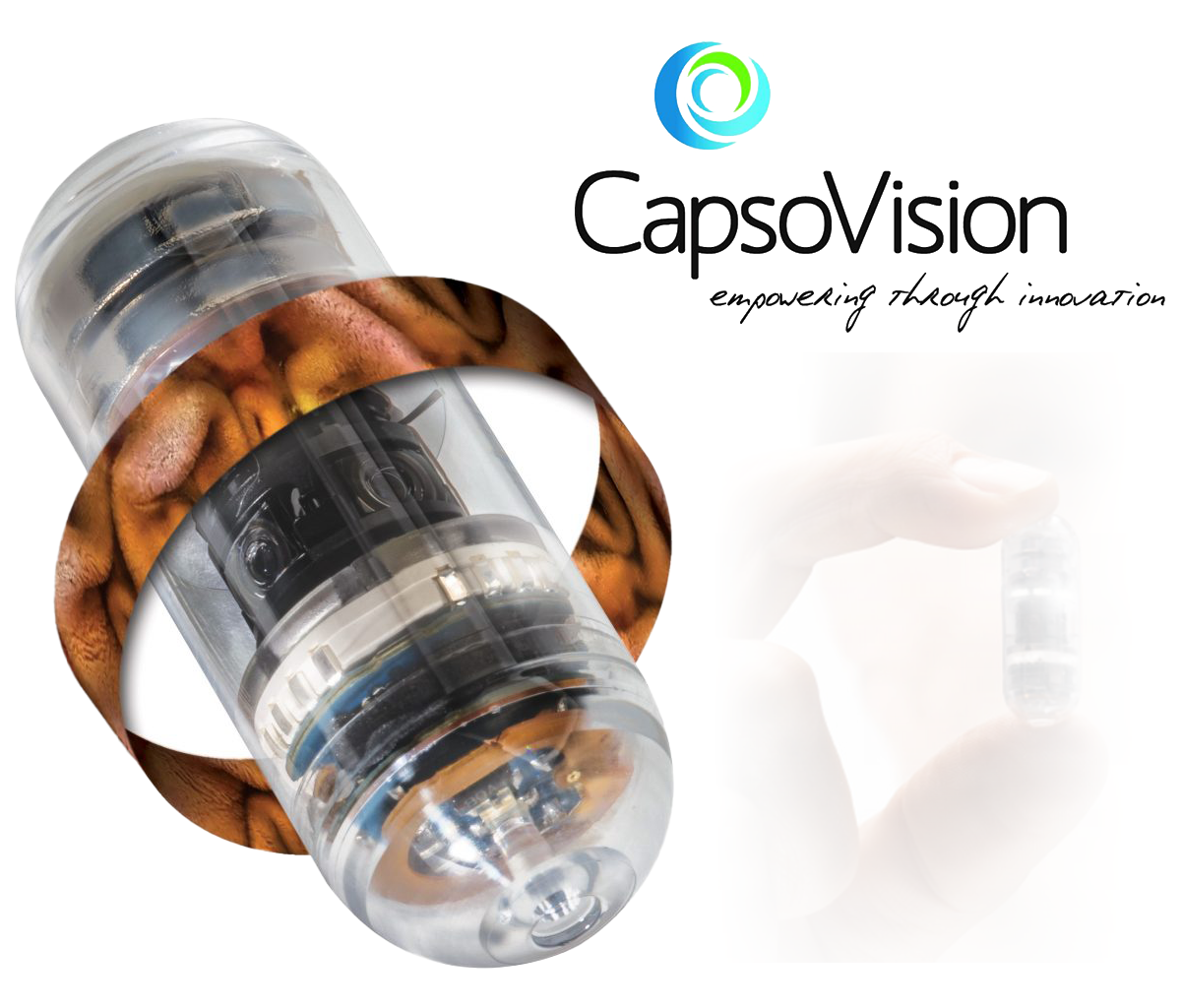 Capsule Endoscopy